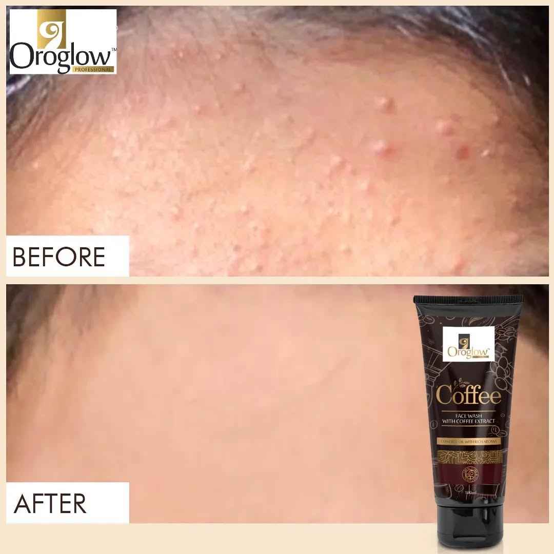 Oroglow Coffee Deep Cleanses | Reduces Puffiness Face Wash (100 ml)