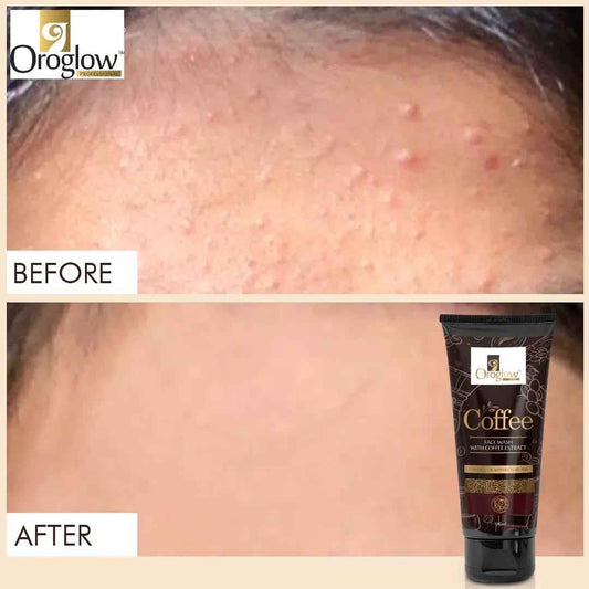 Oroglow Coffee Deep Cleanses | Reduces Puffiness Face Wash (100 ml)